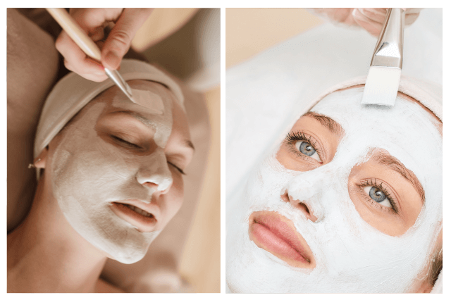 Lip Filler Treatment in Lucknow 